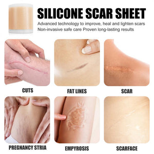 SHEETS™Medical Soft Silicone Gel Tape for Scar Removal